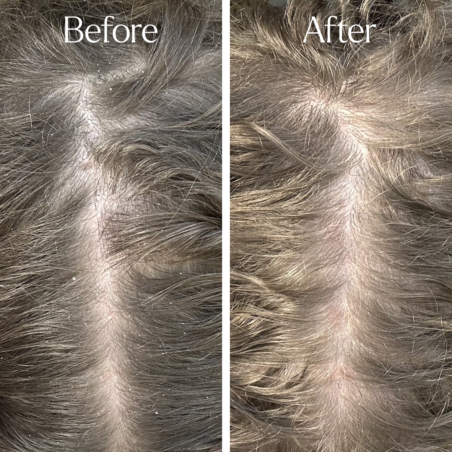 Only Curls Curl Detox Clarifying Shampoo - Only Curls